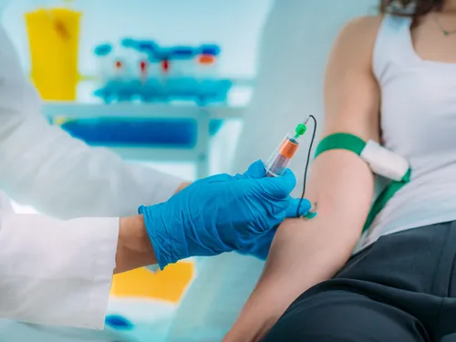 Remboursement phlébologue : quelle prise en charge par l&rsquo;Assurance maladie et la mutuelle santé ?